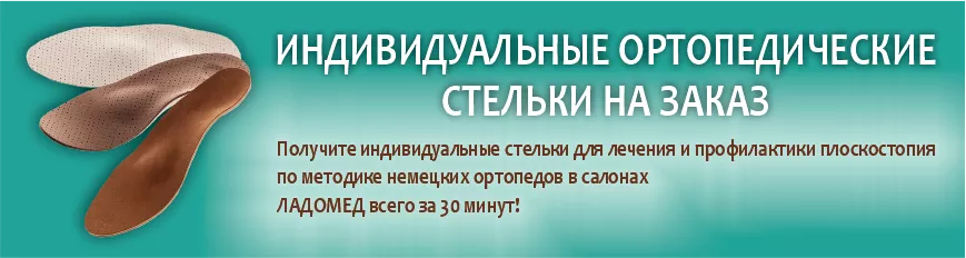 Индивидуальные ортопедические стельки на заказ+